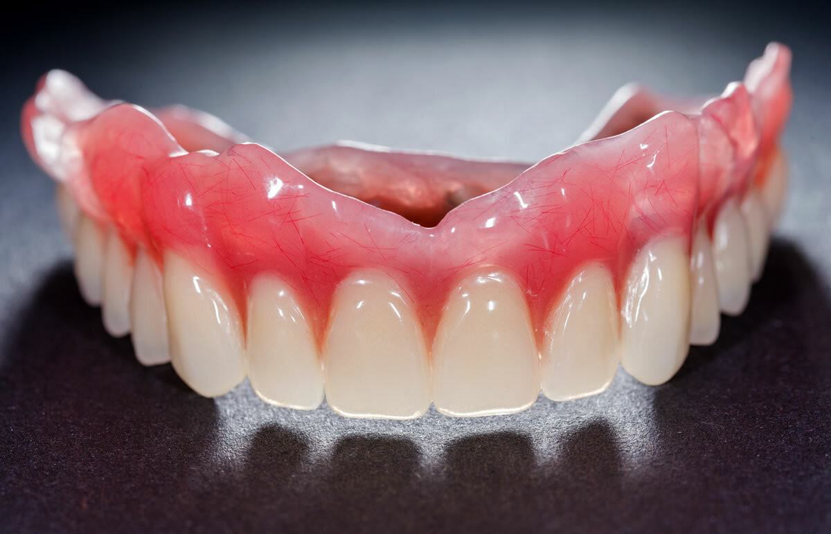 Nejlonovye-zubnye-protezy